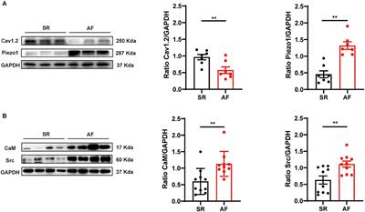 Piezo1 Participated in Decreased L-Type Calcium Current Induced by High Hydrostatic Pressure via. CaM/Src/Pitx2 Activation in Atrial Myocytes